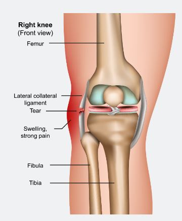 Arthroscopic meniscus repair